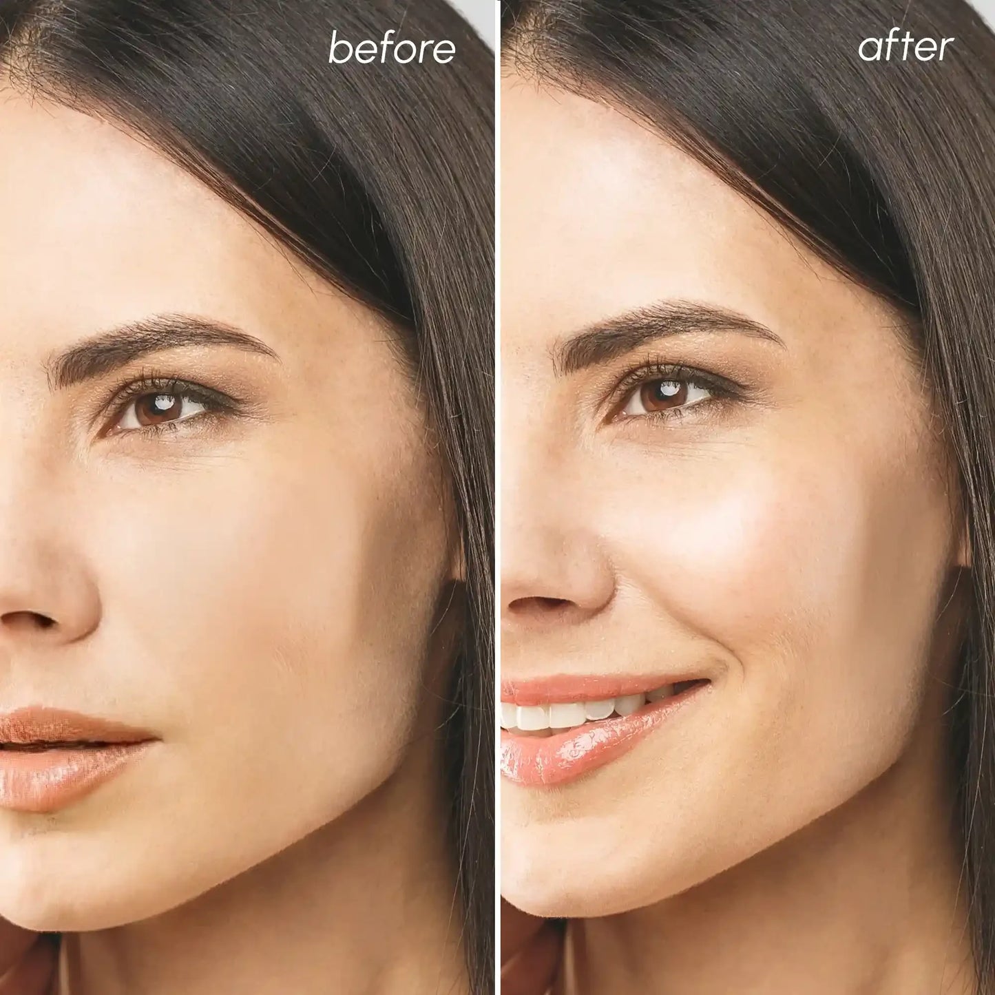 Before and after skincare transformation showing radiant, glowing skin with a natural smile