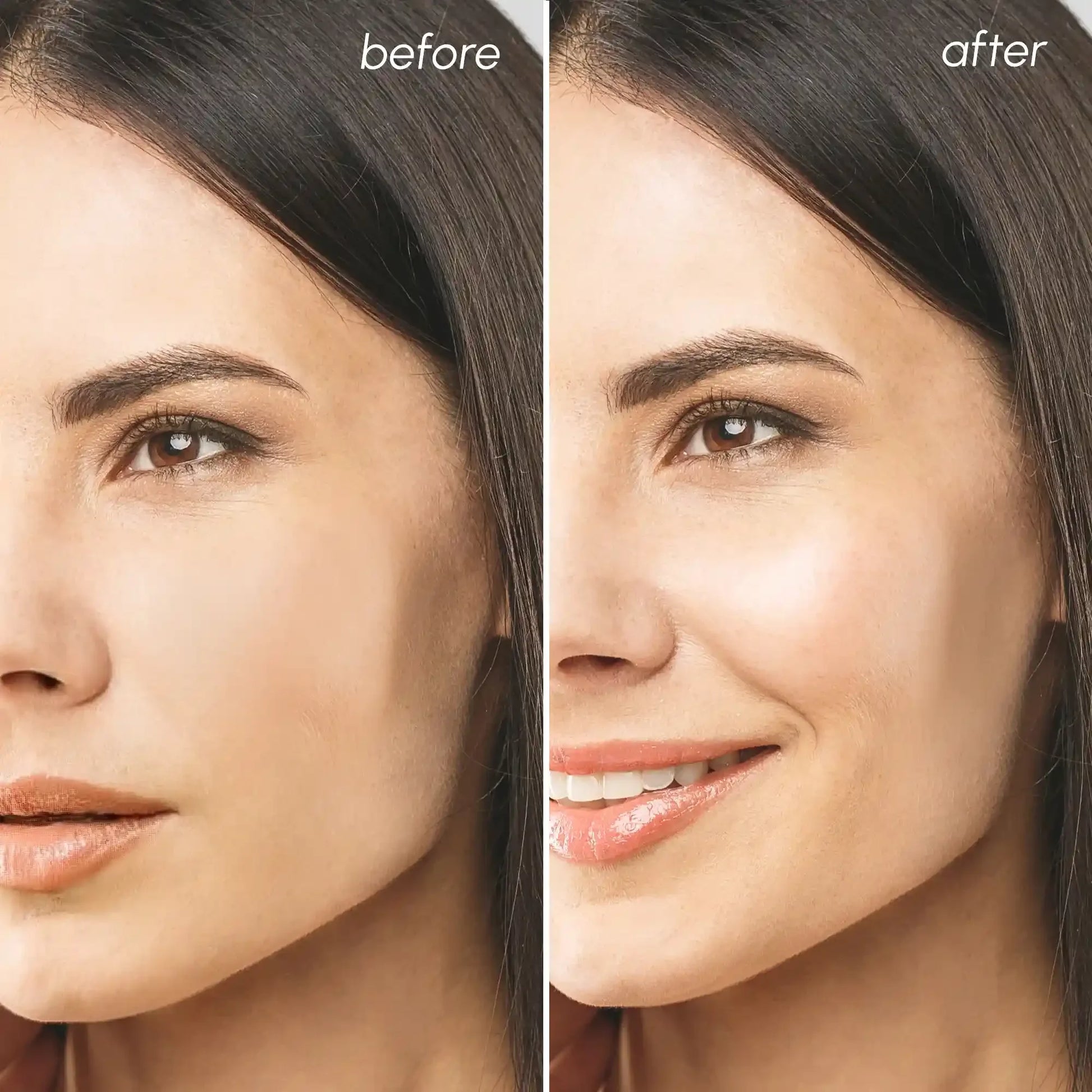 Before and after skincare transformation showing radiant, glowing skin with a natural smile