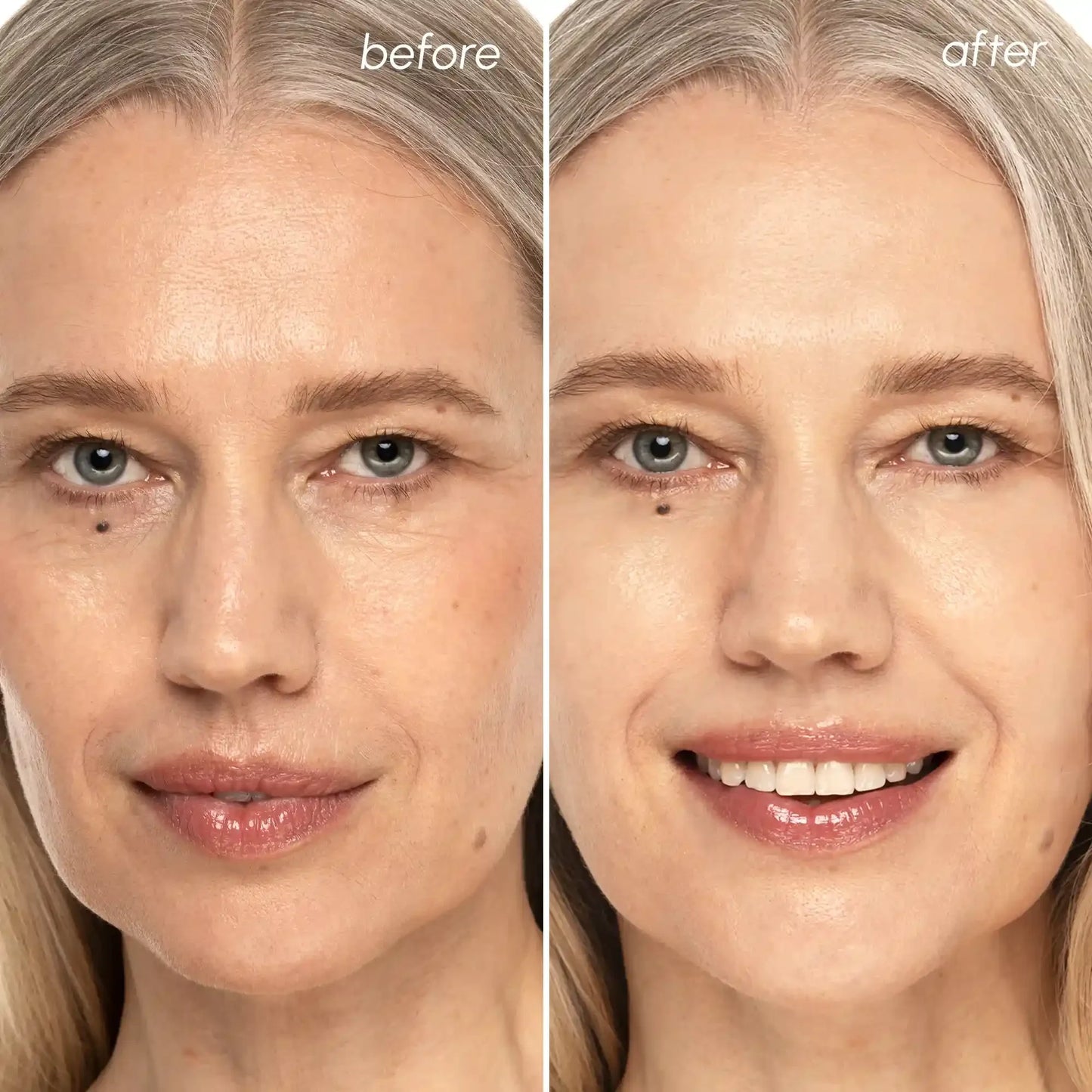 Before and after skincare transformation showing radiant, youthful skin glow