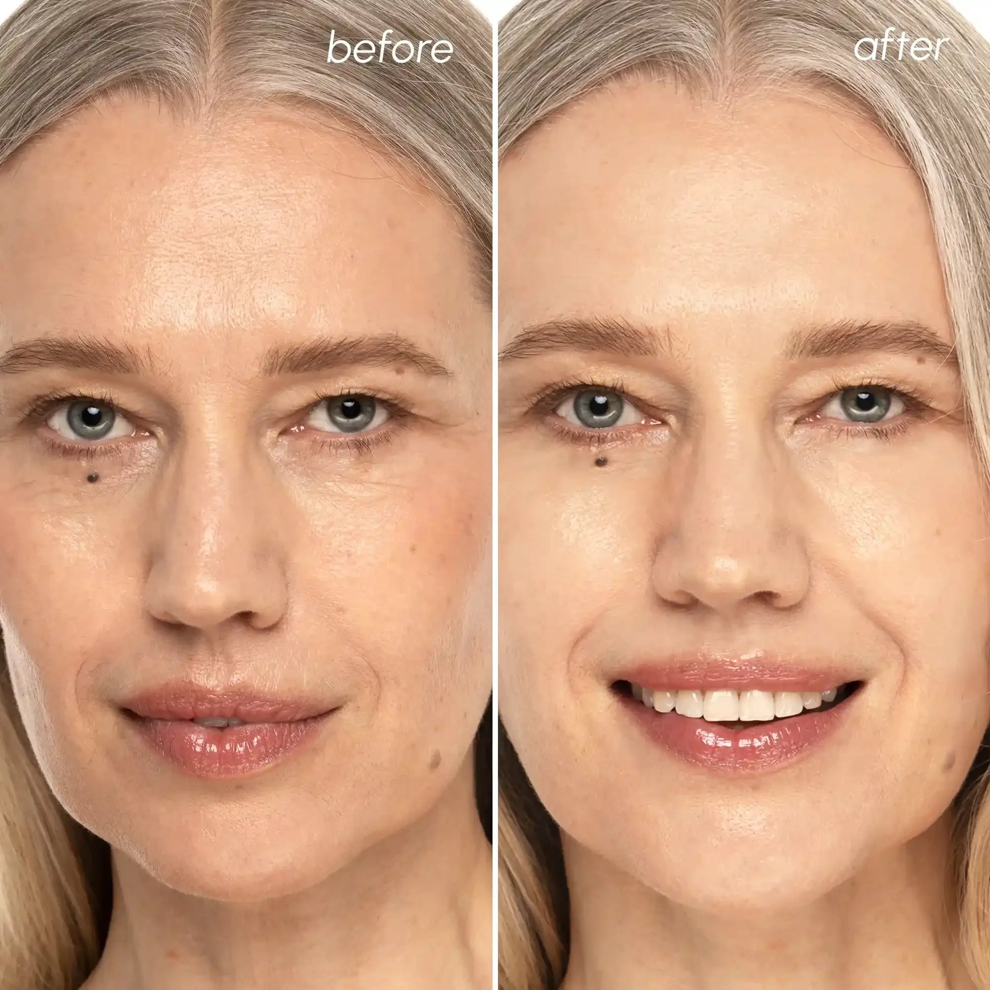 Before and after skincare transformation showing radiant, youthful skin glow